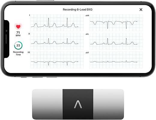 How to Choose the Right Health Monitoring Device for Your Needs